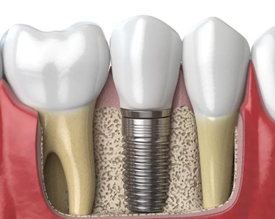 Clínica Dental Nadal